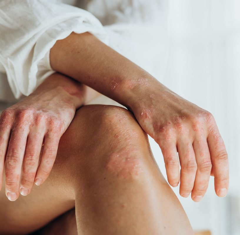 Condition - Miderma